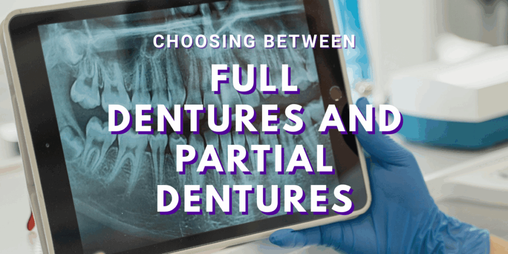 Choosing Between Full Dentures and Partial Dentures